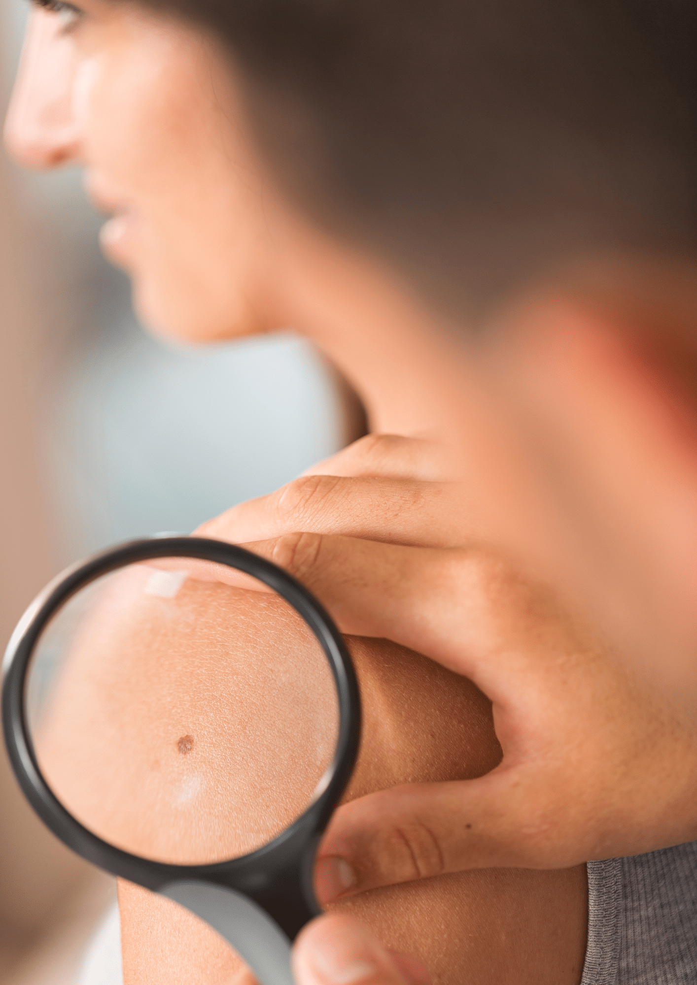 Prévention cancer de la peau