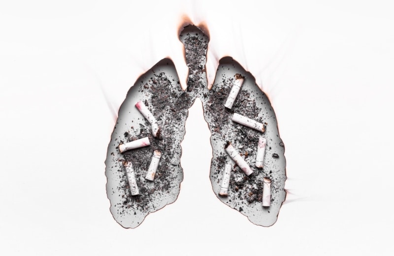 Hôpital sans tabac