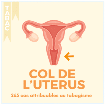 TABAC – 17 LOCALISATIONS (13)