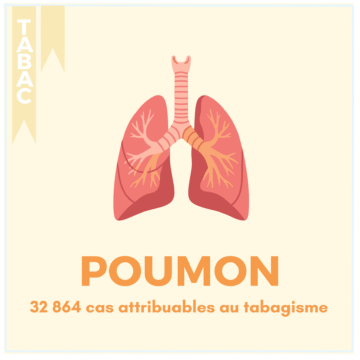 TABAC – 17 LOCALISATIONS