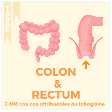 TABAC – 17 LOCALISATIONS (5)