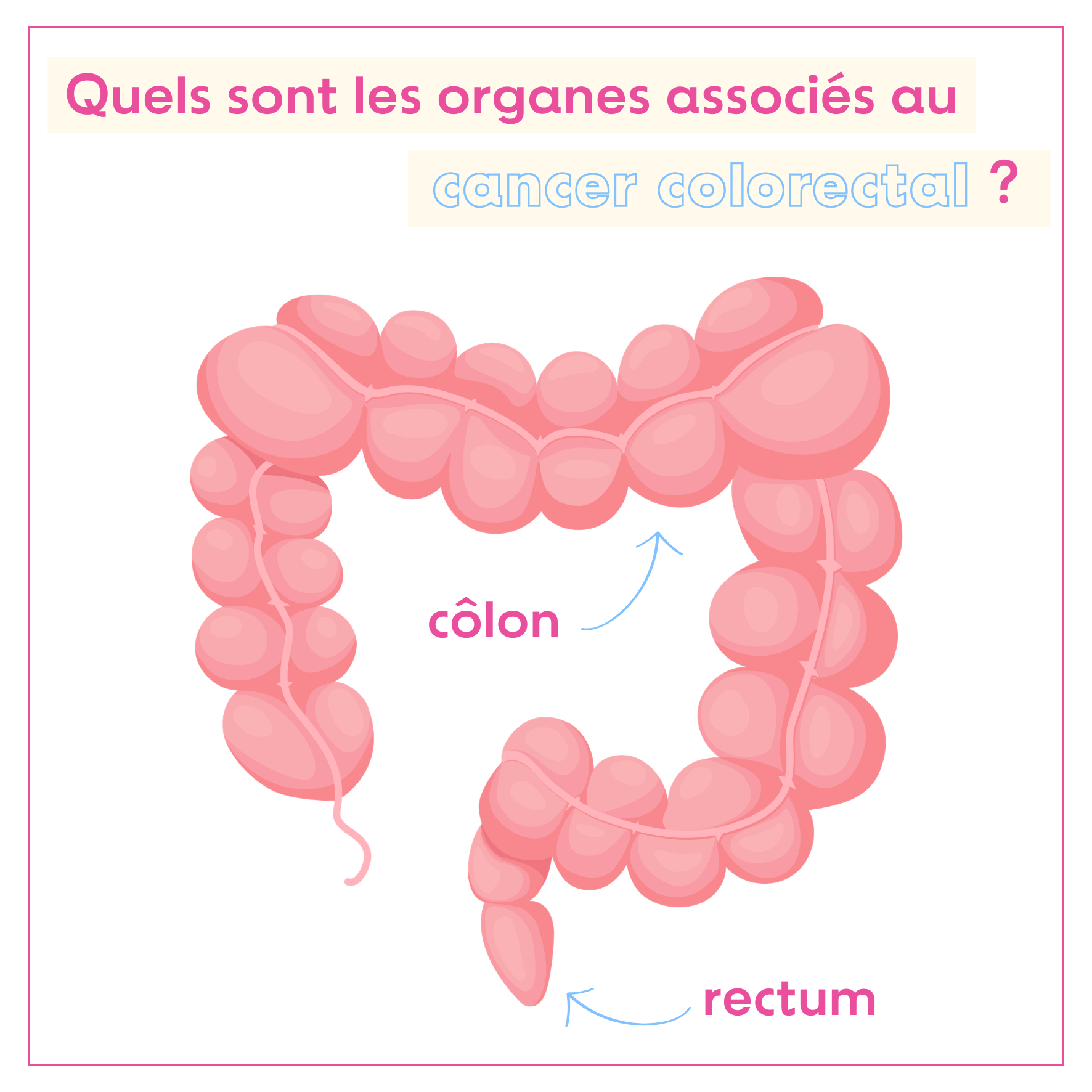 Quels sont les organes associés au cancer colorectal > Le colon et le rectum